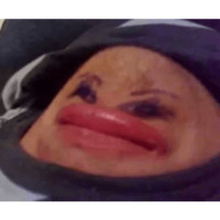 Подбородки