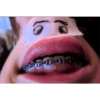 Подбородки