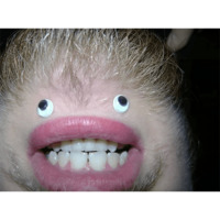 Подбородки